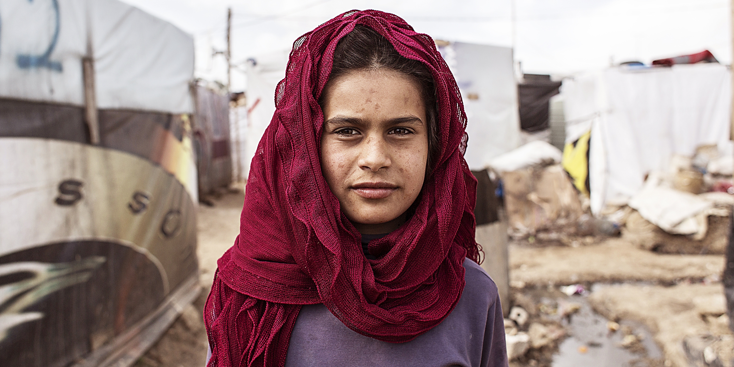 A 12-year-old Syrian girl, in the Anjar Refugee camp in Lebanon. Premiumaid Foundation offers programs in the camp to help keep refugee children healthy, educated and safe.  