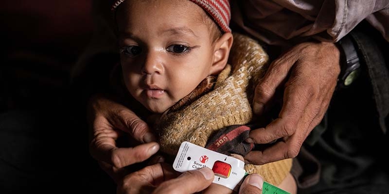 Afghanistan, a baby being assessed for malnutrition at a mobile health clinic